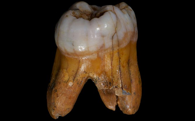 Denisovans-tooth